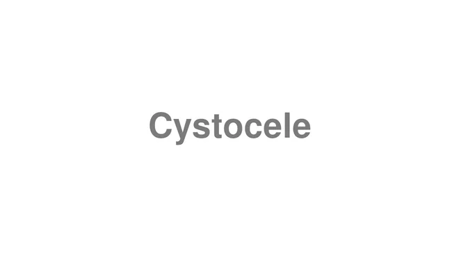 How to Pronounce Cystocele