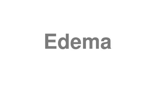 How to Pronounce Edema